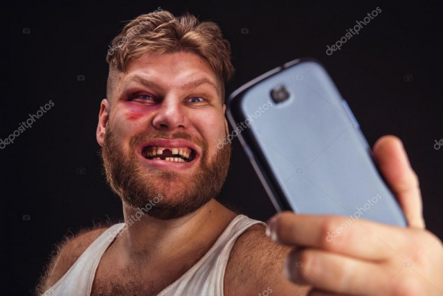 depositphotos_67616011-stock-photo-man-with-bruise-takes-selfie.jpg